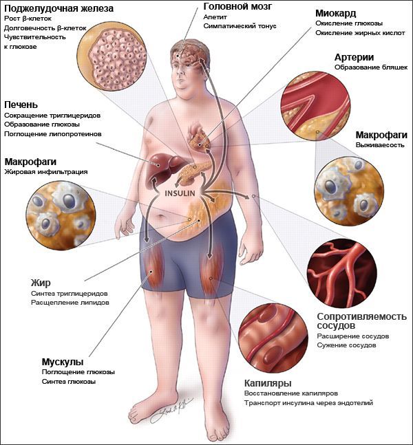 Гепатит с і цукровий діабет: способи лікування та профілактика