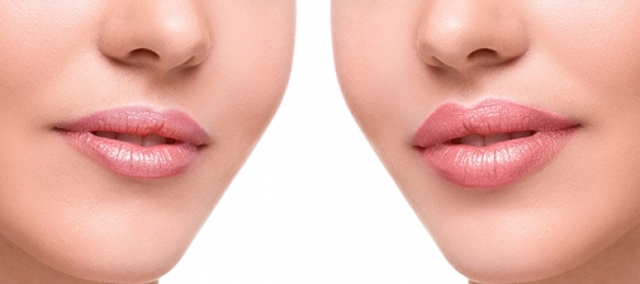 7 рад, щоб отримати шикарні губи