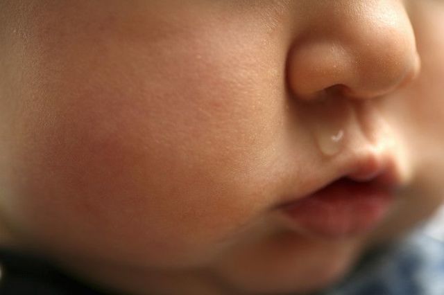 Нежить у немовлят, в тому числі при прорізуванні зубів