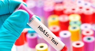 Глікозильований гемоглобін: норма у жінок, чоловіків, дітей за віком, що означає, як здавати аналіз, розшифровка