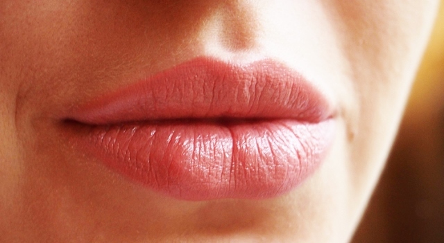 Набряк губ і його причини - алергія, травми, виразки і хвороби.  фото
