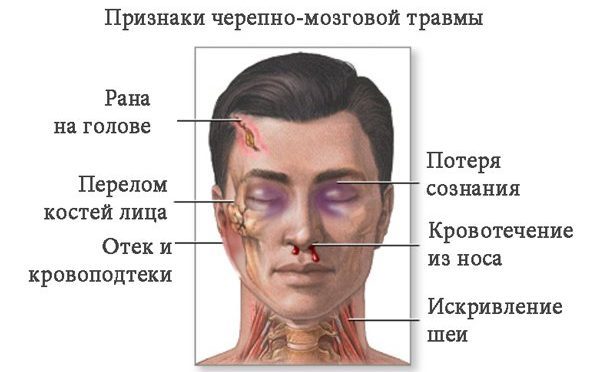 Оніміння шкіри голови - причини і лікування