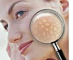 Жирна шкіра на носі - причини і лікування
