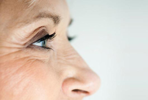 Вікові плями на обличчі - причини, лікування і домашні засоби
