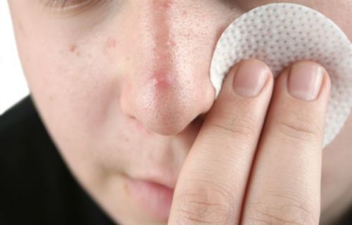 Угри на губах - причини, лікування в домашніх умовах