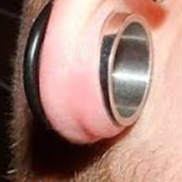 Зараження пірсингу вуха - фото, симптоми, лікування