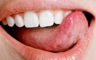 Чому солодкий присмак у роті і чим це загрожує?