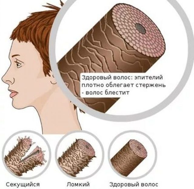 Нав'язливе розчісування шкіри голови - причини, симптоми лікування