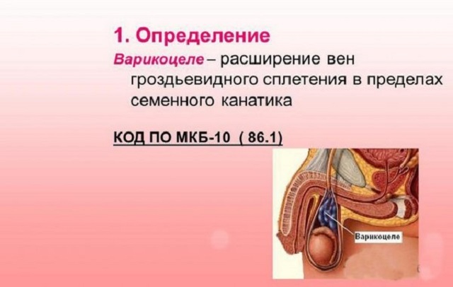 Варикоцеле зліва (1 і 2 ступеня): МКБ 10, причини, симптоми і лікування у чоловіків