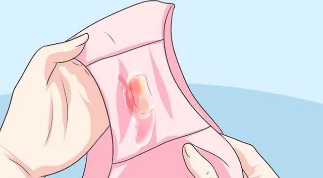 Колір вагінальних виділень у жінок - нормальний і тривожний