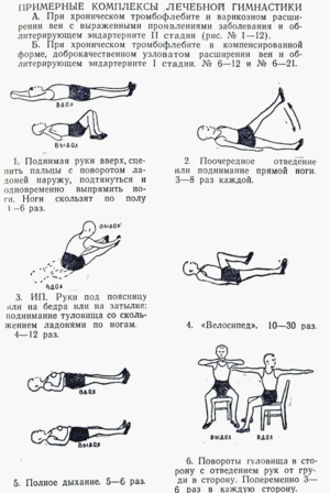 Вправи при варикозі нижніх кінцівок: гімнастика, зарядка на роботі, лікувальна фізкультура (ЛФК)