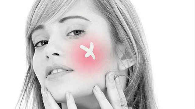 Лікування купероза на обличчі