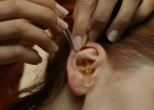 Прищі у вушній раковині, всередині вуха і за ним - причини і лікування