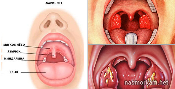 Дере, лоскоче в горлі і кашель - причини і лікування