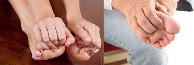 Розпух великий палець на нозі - причини, фото, лікування