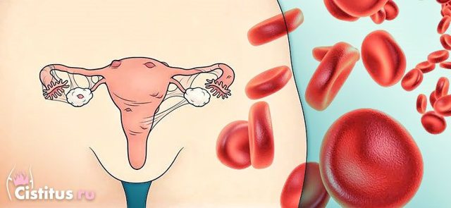 Як впоратися з кровотечею при ендометріозі