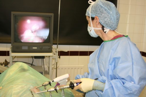 Лапароскопія кісти яєчника у жінок: видалення і операція
