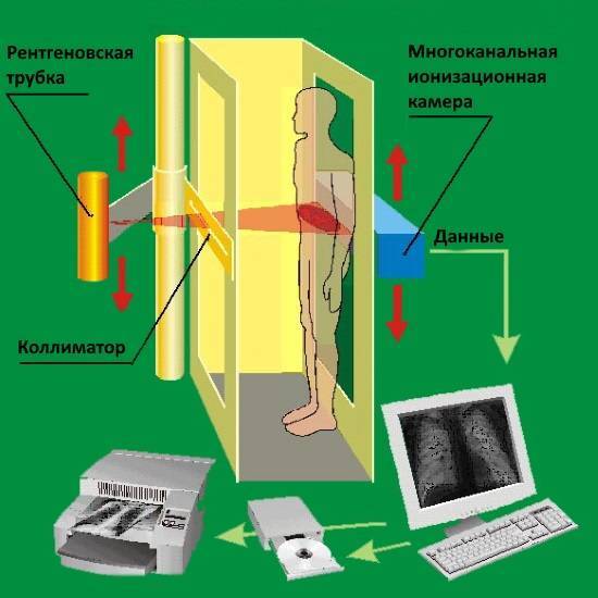 Флюорография и рентген легких: в чем разница