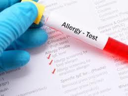 Як дізнатися, на що проявляється алергія, особливо лабораторних алергічних тестів