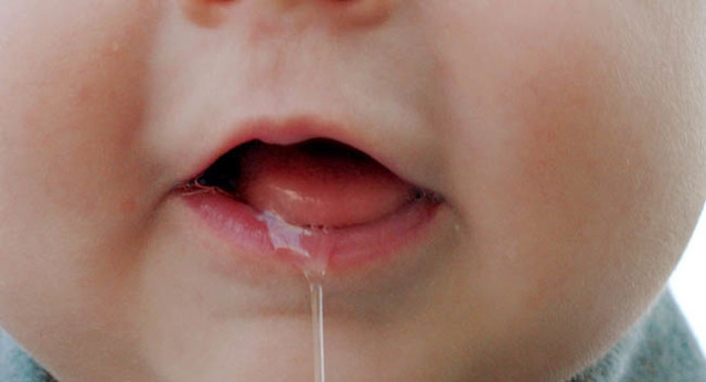 Як допомогти дитині впоратися з сверблячкою під час прорізання зубів