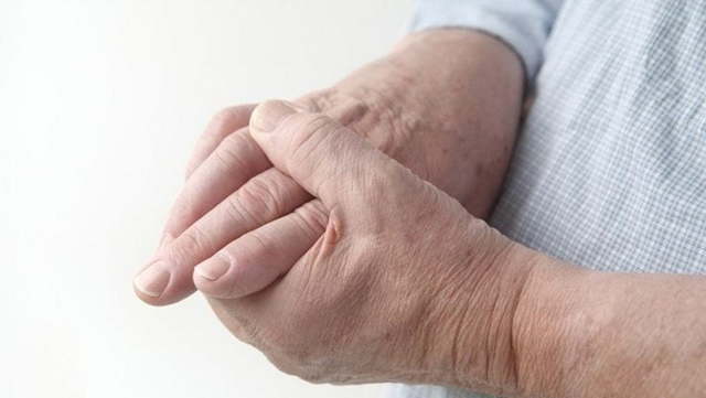 Ревматоїдний артрит пальців рук, перші симптоми