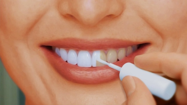 Як відбілити зуби в домашніх умовах
