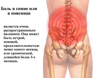 Болі в спині в області попереку: причини
