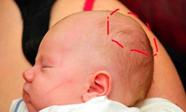 Ознаки струсу мозку у дитини