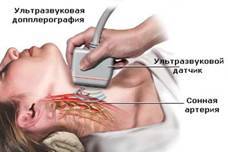 Триплексне сканування судин шиї та головного мозку