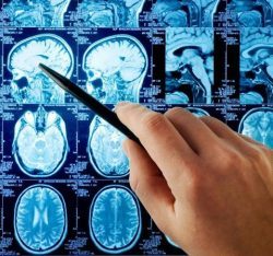 Як робиться МРТ головного мозку