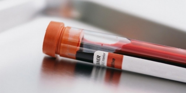 Переливання крові від прищів: особливості процедури, принципи лікування