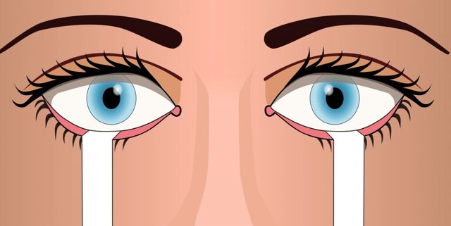 Симптоми і способи лікування синдрому сухого ока