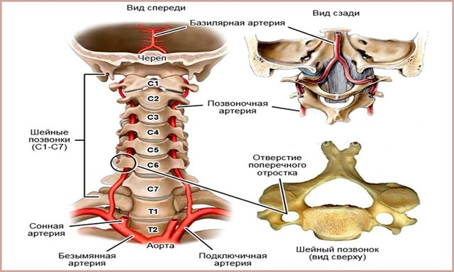 Синдром хребетної артерії при шийному остеохондрозі і його симптоми