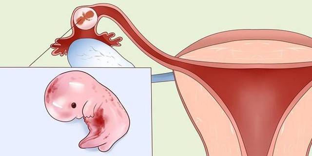 Які бувають кровоспинні препарати при маткових кровотечах