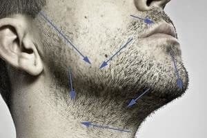 Прищі після гоління: причини появи і способи боротьби