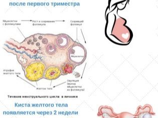 Названіченіе жовтого тіла в яєчнику при вагітності