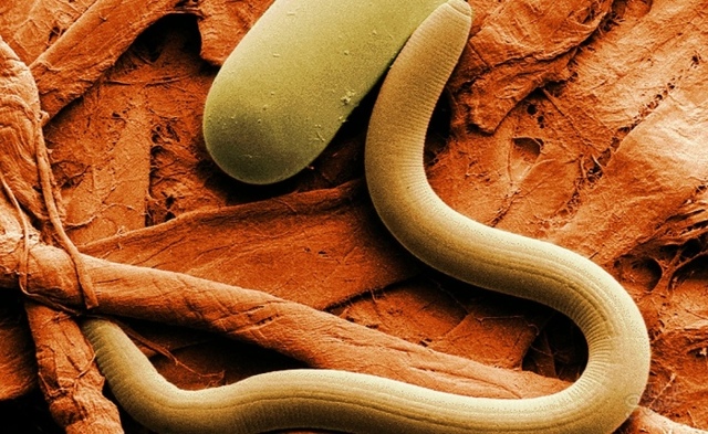 Народні засоби від паразитів в організмі людини
