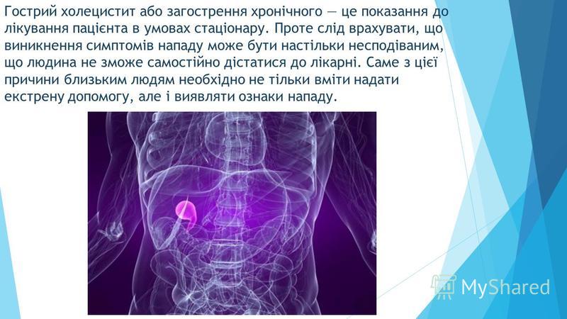 Созылмалы холецистит презентация